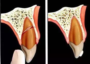 omg卡住了怎么回事,omg治疗