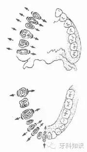 口腔拔牙图片,口腔拔牙麻醉多久消退