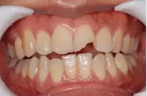 omg卡住了怎么回事,omg治疗