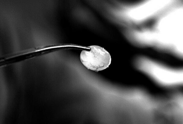 整形美容改变颜值,昆明整形失败如何补救