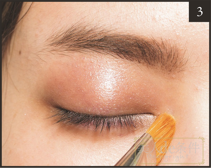 眉头太低打玻尿酸怎么能提上去,经常皱眉要不要打玻尿酸