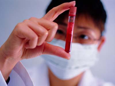 手把手教看懂医院化验单,教你简单读懂化验单