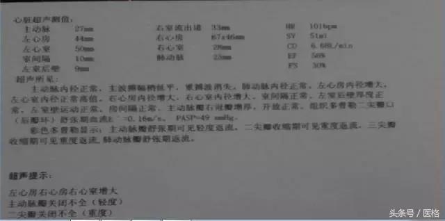 心内医生看过来，反复腹胀12年，她到底得了什么病？