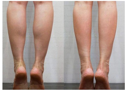 6个下身肥胖的原因及对策!不看就继续肥下去吧