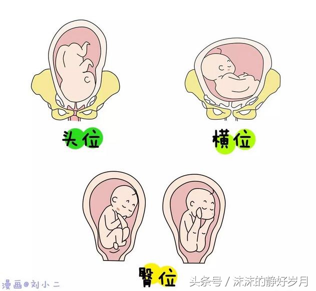 孕26周宝宝臀位还能转过来吗,孕晚期胎宝宝还是喜欢臀位