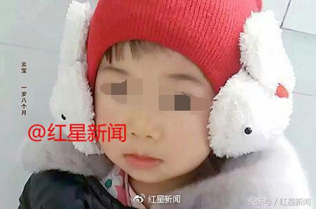 4岁女童遭开水烫伤最终结果,2岁女儿被开水烫伤完整版