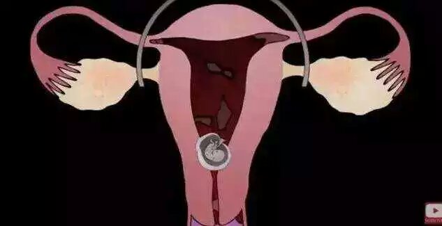 男的会接受女朋友打胎吗,你会建议你的女朋友打胎吗