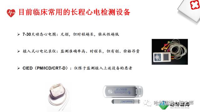 「心声」长程心电检测设备在房颤管理中的重要地位
