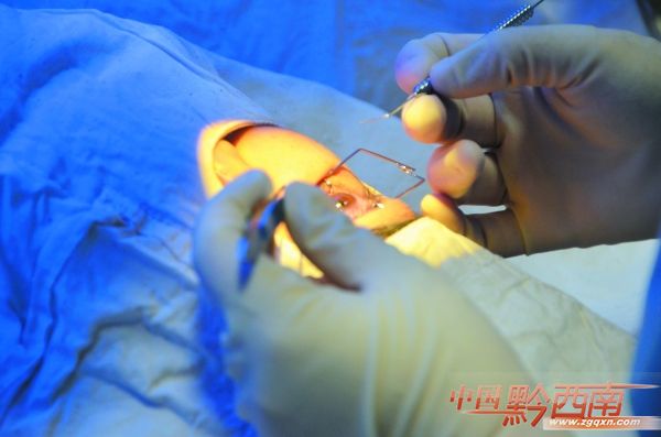 秒杀老花镜,秒杀角膜塑形镜