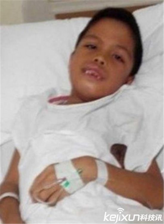 男孩嘴里有526颗牙,男孩多牙症300颗牙齿