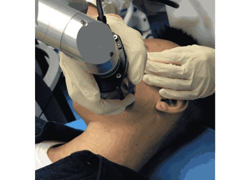 我的祛斑血泪史完整版,我的祛痘史