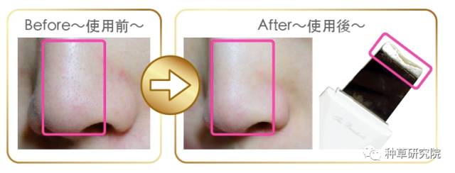 怎么才能让皮肤像水煮蛋样,如何让皮肤嫩得像剥壳的鸡蛋