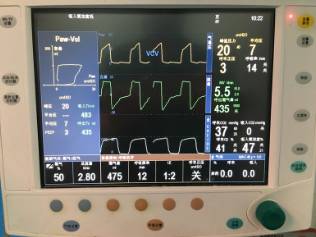 围手术期个案护理比赛优秀案例ppt,术后镇痛的规范化管理ppt