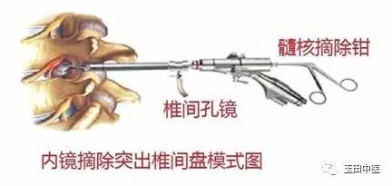 疼痛科最佳诊断,疼痛科专用器械大全