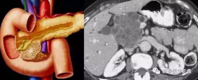 18种疾病包括哪些,18种肿瘤有哪些