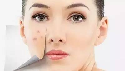 再也不担心脸上长痘痘,再也不用因为痘痘而烦恼