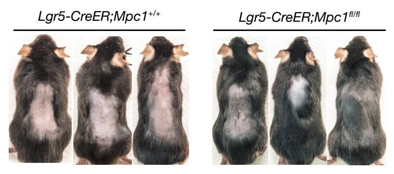 自然疗法治脱发,自然卷脱发能自愈吗