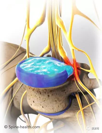 解决坐骨神经痛的穴位,坐骨神经最快治愈手法