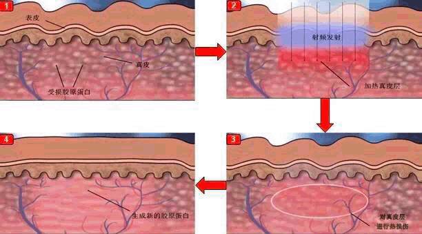 美容仪的干货分享,干货科普家用美容仪红黑榜