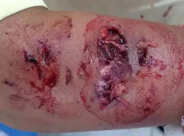 狗苗抓回来要打疫苗吗,买狗苗给狗苗打什么疫苗