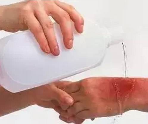 烧伤怎么处理好得快可以用牙膏吗,烧伤用云南白药牙膏好吗