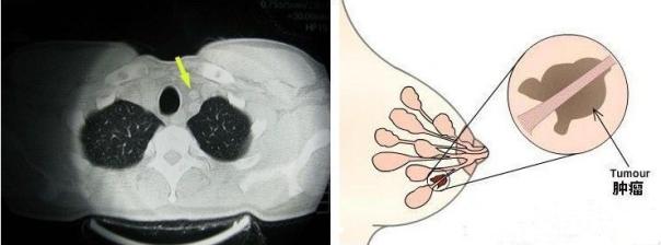 女性患上三大瘤罪魁祸首竟是内分泌失调专栏