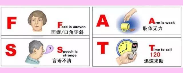 东莞中风救治定点医院,东莞治疗脑卒中最好的医院