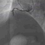 典型病例及处理方法,典型病例分析及治疗方法