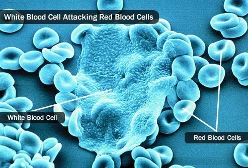 免疫系统出了问题是什么病,免疫系统出了问题会得什么病