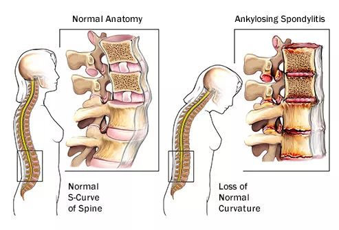 免疫系统出了问题是什么病,免疫系统出了问题会得什么病
