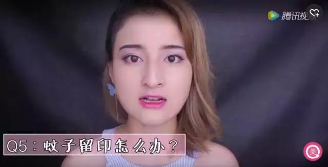 夏天防蚊子叮咬的22妙招,防蚊止痒的最佳方法