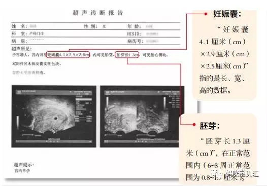 先兆流产有胎芽胎心能成功吗,先兆流产有胎心胎芽能保住吗
