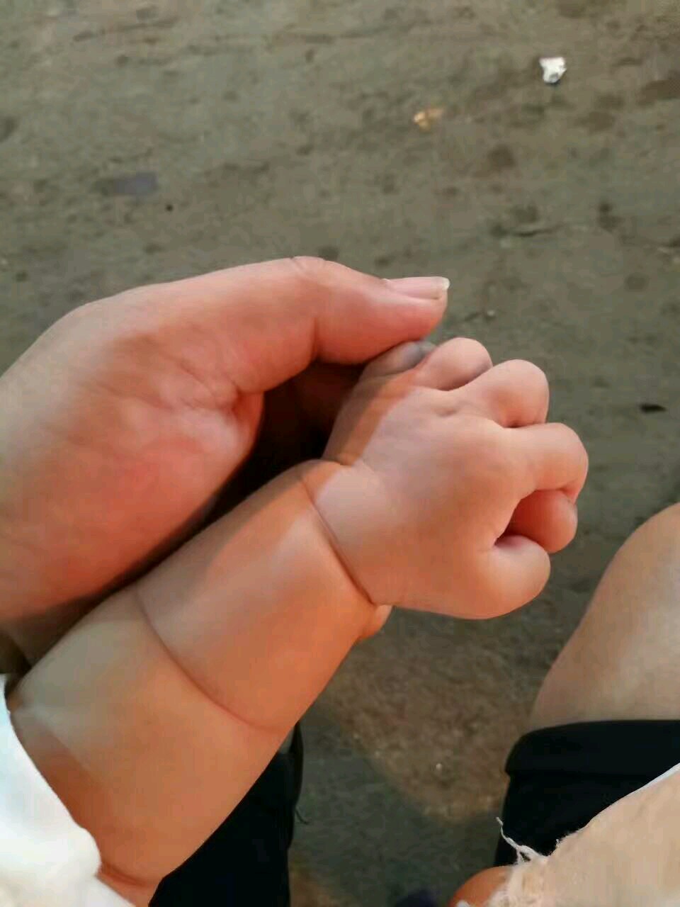 马蹄足内翻宝宝康复记，给相同经历的宝妈一些正能量