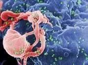 狂犬病毒vs埃博拉病毒,埃博拉病毒和狂犬病毒哪个更厉害