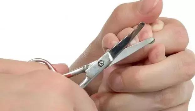 给婴儿剪脚指甲怎么预防甲沟炎,宝宝甲沟炎如何剪脚趾甲