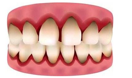 娌荤枟鐗欓緢鑲跨棝鐨勪腑鑽潗,鏇跨鍞戞不鐤楃墮榫堣偪鐥涘悧