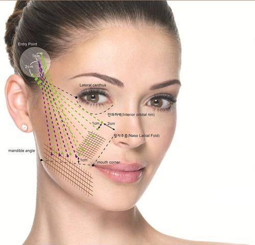 为什么做完蛋白矫正发尾会翘,为什么做完蛋白矫正会头痒