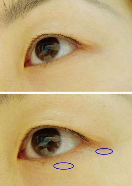 夜谈奔三女眼部千日养护记