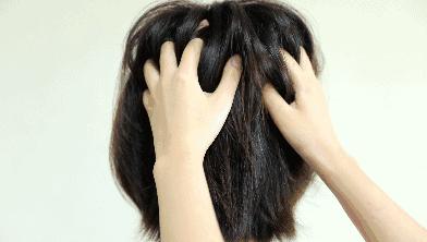 脱发秃发怎么回事,每次洗头掉发正常还是秃了