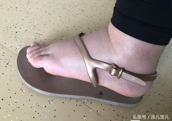 孕34周脚肿了两天突然又消肿了,孕34周脚肿是入盆了吗