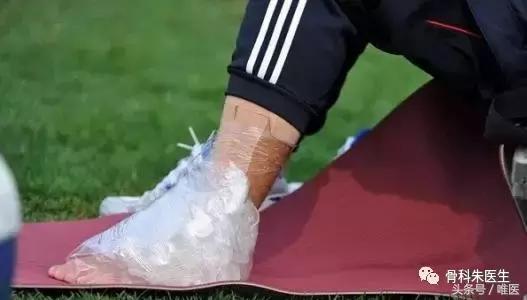 骨科脚踝扭伤怎么快速恢复,医生会怎么处理脚踝扭伤