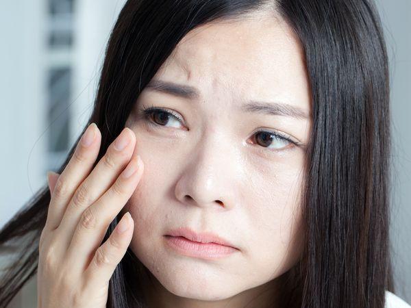 皮肤敏感自救指南,皮肤敏感的解决思路