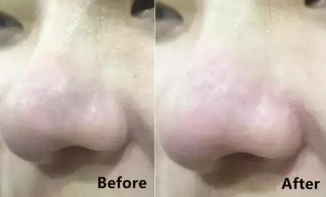 巧克力面膜美白淡斑去黑头粉刺,去黑头粉刺涂抹式面膜好物分享