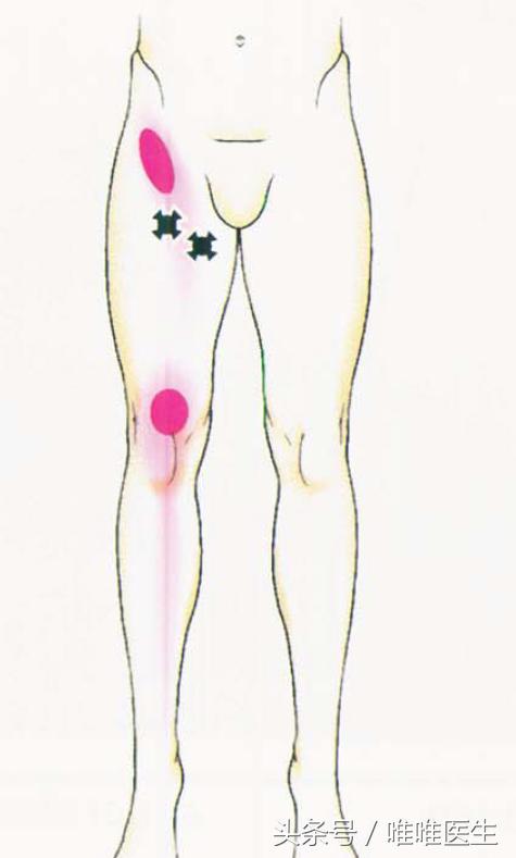 膝关节科普文章,膝关节疼痛最全解析