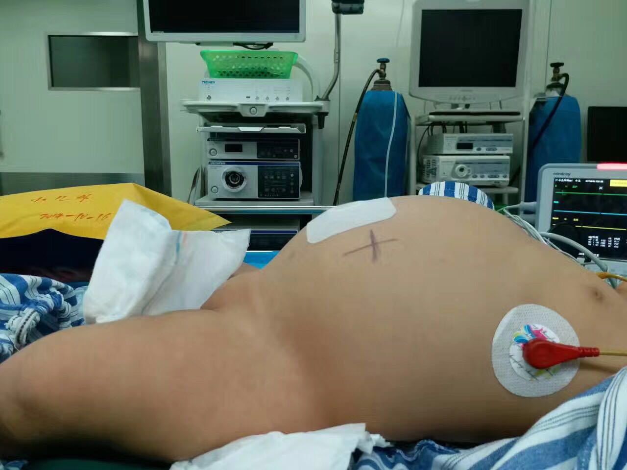 宝宝肚子胀呕吐腹泻哭闹,宝宝肚子咕噜呕吐拉肚子