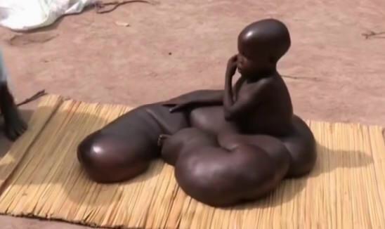 人类最大的身体器官有多大,世界上人类最大的身体器官