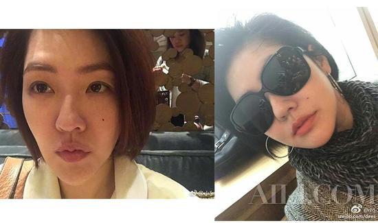 明星脸上的痣是怎么去掉的,明星都是怎么去掉脸上的痣