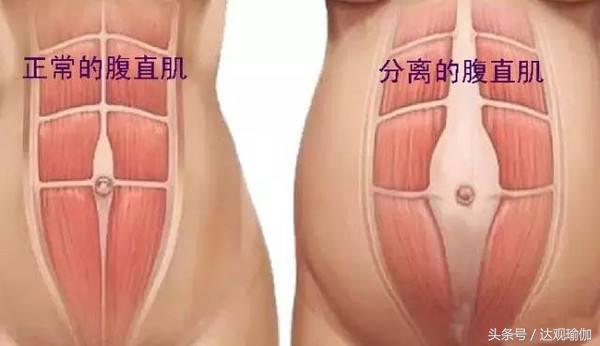 产后妈妈为什么需要做产后修复,瑜伽产后修复和美容院产后修复