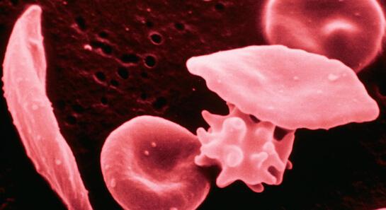 皮肤长小红痣不痛不痒是什么原因,身上长了好多小红痣是什么症状