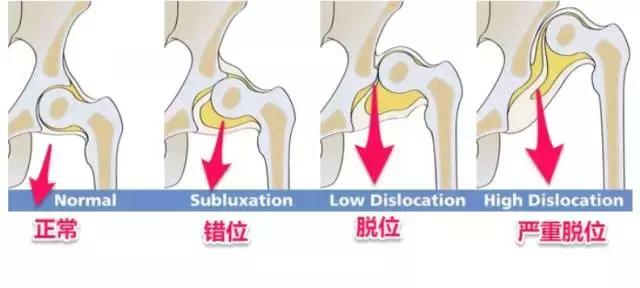 宝宝腿纹不对称是拍ct还是彩超,腿纹不对称但是双腿蹬起来很有力